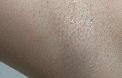 Thumbnail of post image 104